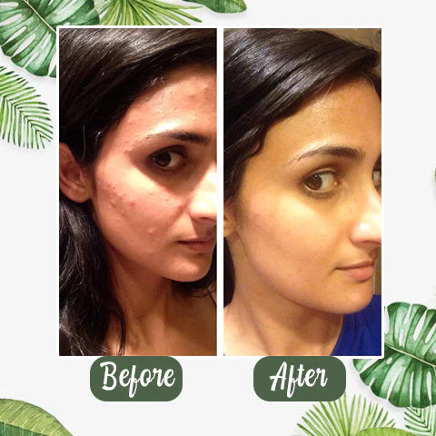 GreenPure – Deep Cleanse Clay Stick