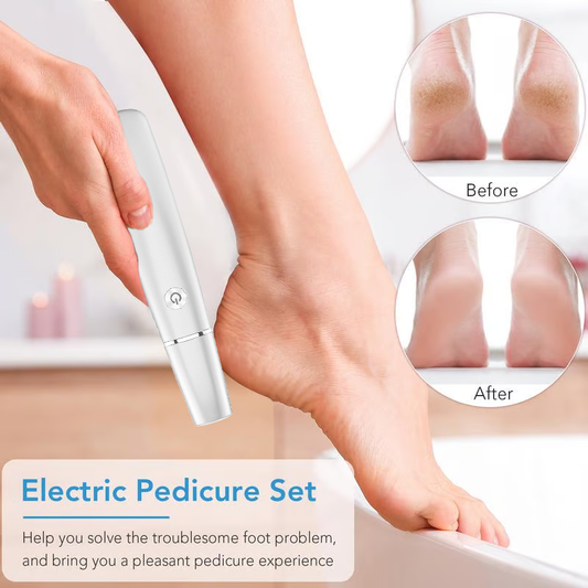 SoleSmooth - Electric Foot Callus Remover