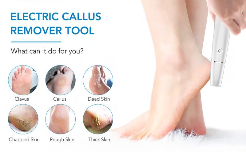 SoleSmooth - Electric Foot Callus Remover