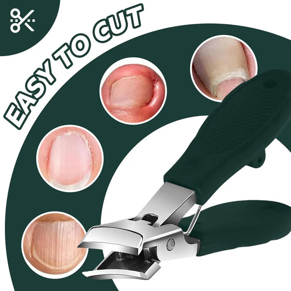 PrecisionEdge – Ultra Sharp Nail Clippers