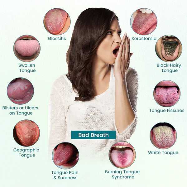 GlosShield – Healing Tongue Repair Spray