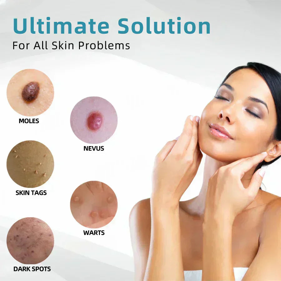 ✨VelvetSkin+™ All-in-One CO₂ Laser Eraser Pen | Removes Moles, Warts, Skin Flaws & Pigmentation