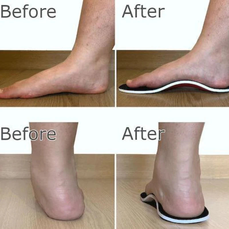 FlexiArch – Slim Orthotic Cushion Insoles