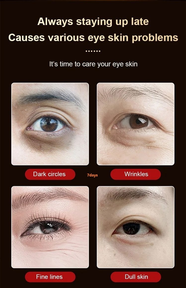 LuteinLift – Nourishing Eye Oil by Dinkiss