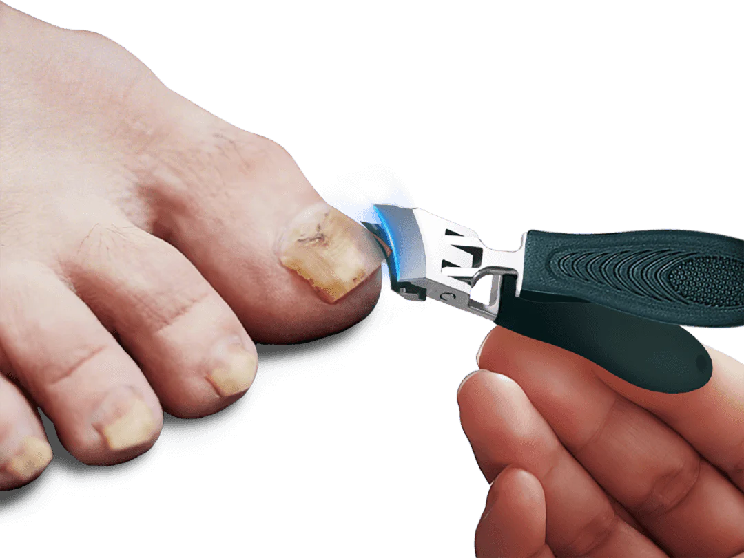 CleanCut – Precision Nail Clipper