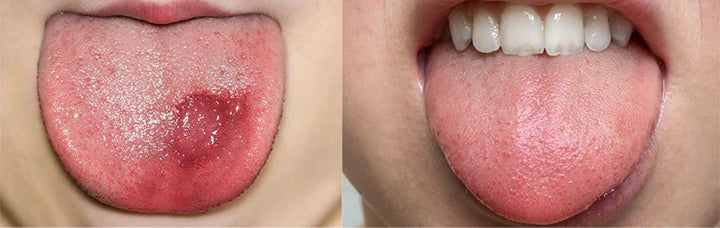 GlosShield – Healing Tongue Repair Spray