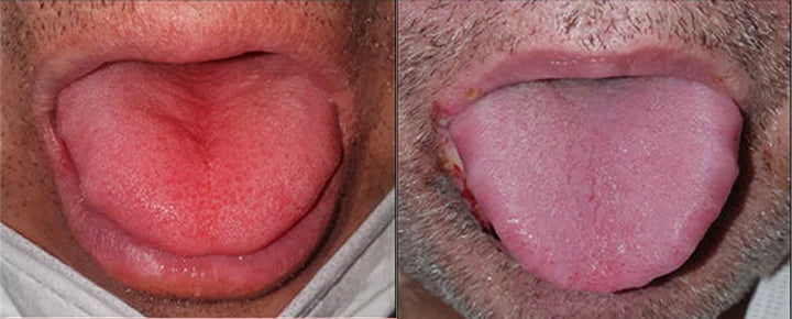 GlosShield – Healing Tongue Repair Spray
