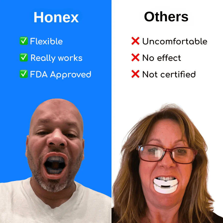 SilentGuard – Universal Anti-Snoring Mouthpiece