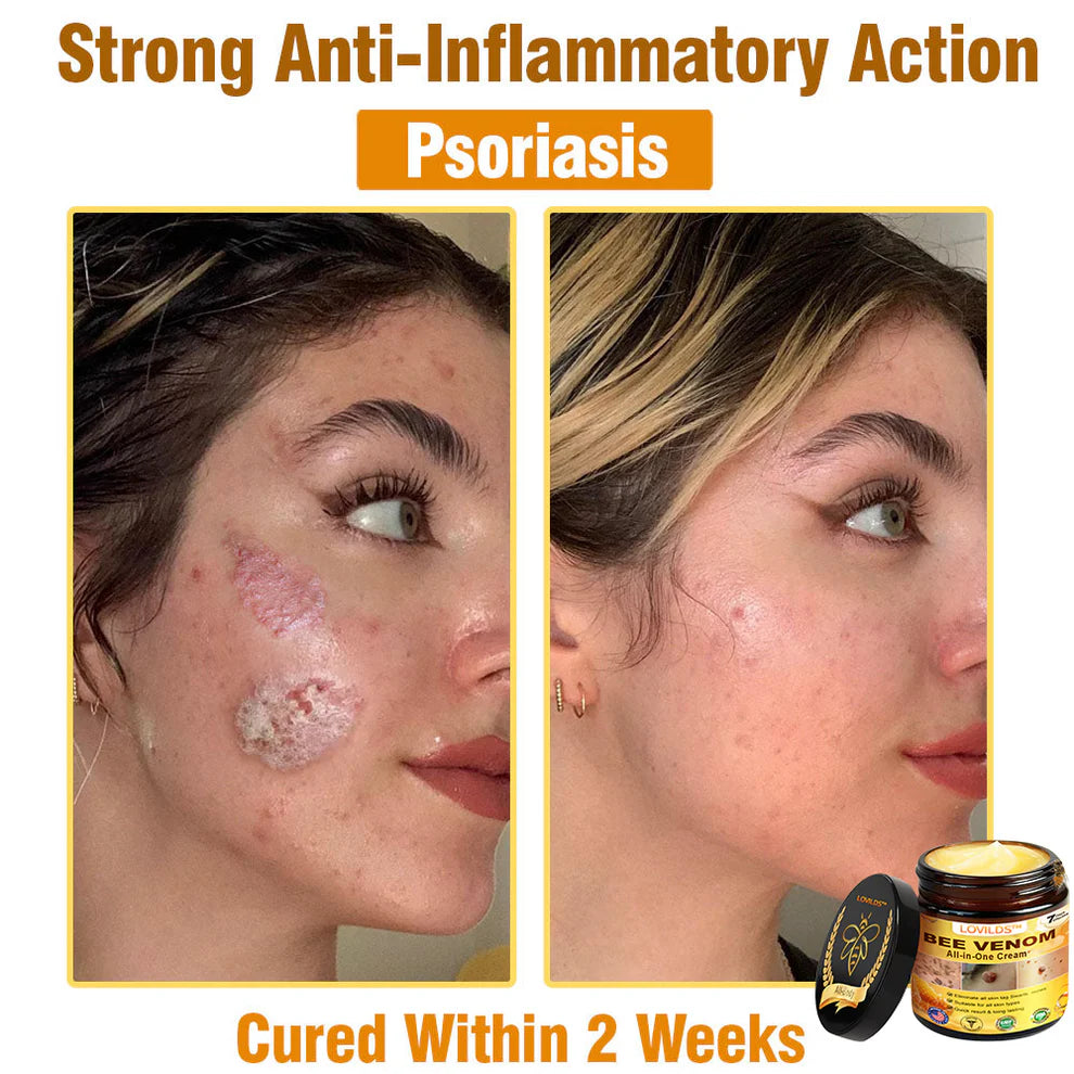 VenomGlow – Youthful Radiance Cream