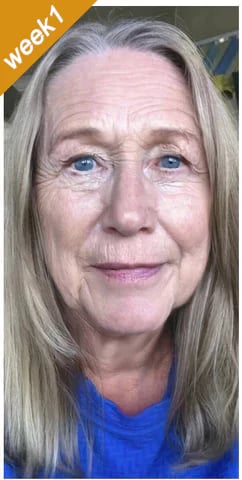 BeeYouth – Botox & Bee Venom Wrinkle Cream