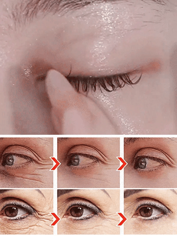 LuteinLift – Nourishing Eye Oil by Dinkiss