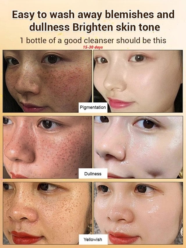 SpotlessGlow – Anti Freckle Essence Oil