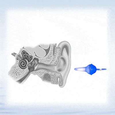 EarFlex – Inflatable Noise-Blocking Earplugs