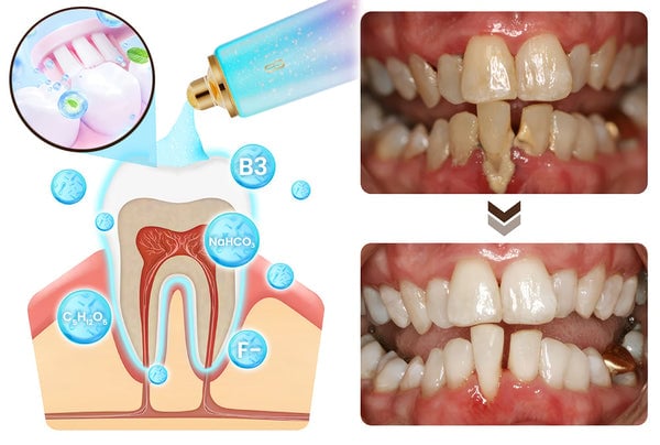 FreshBright – Fluoride-Free Toothpaste, Triple Whitening