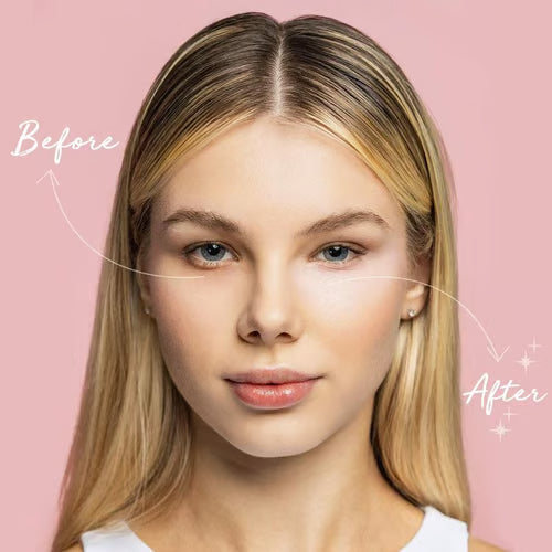 RadiantEyes – Dark Circle Corrector