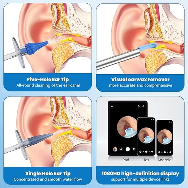 EarGlow – Wireless Ear Cleaning Endoscope