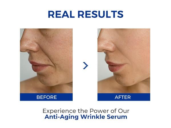 GlowRenew - Wrinkle Smoothing Facial Serum