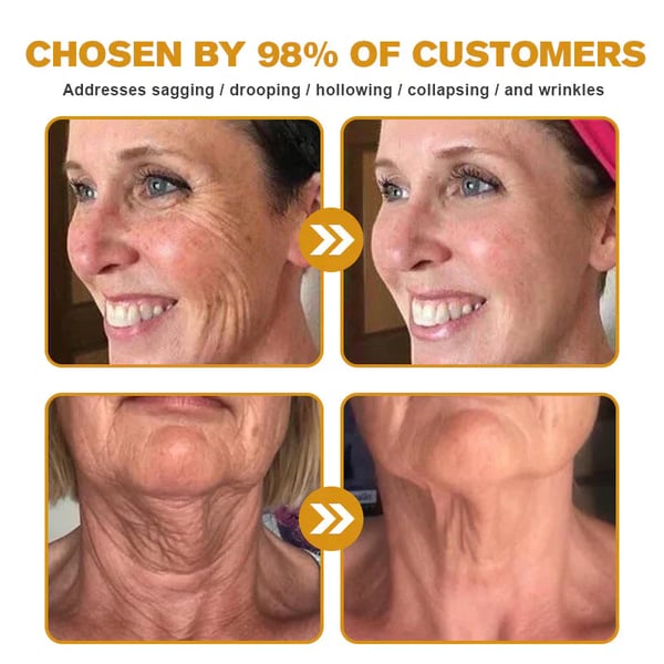 BeeYouth – Botox & Bee Venom Wrinkle Cream