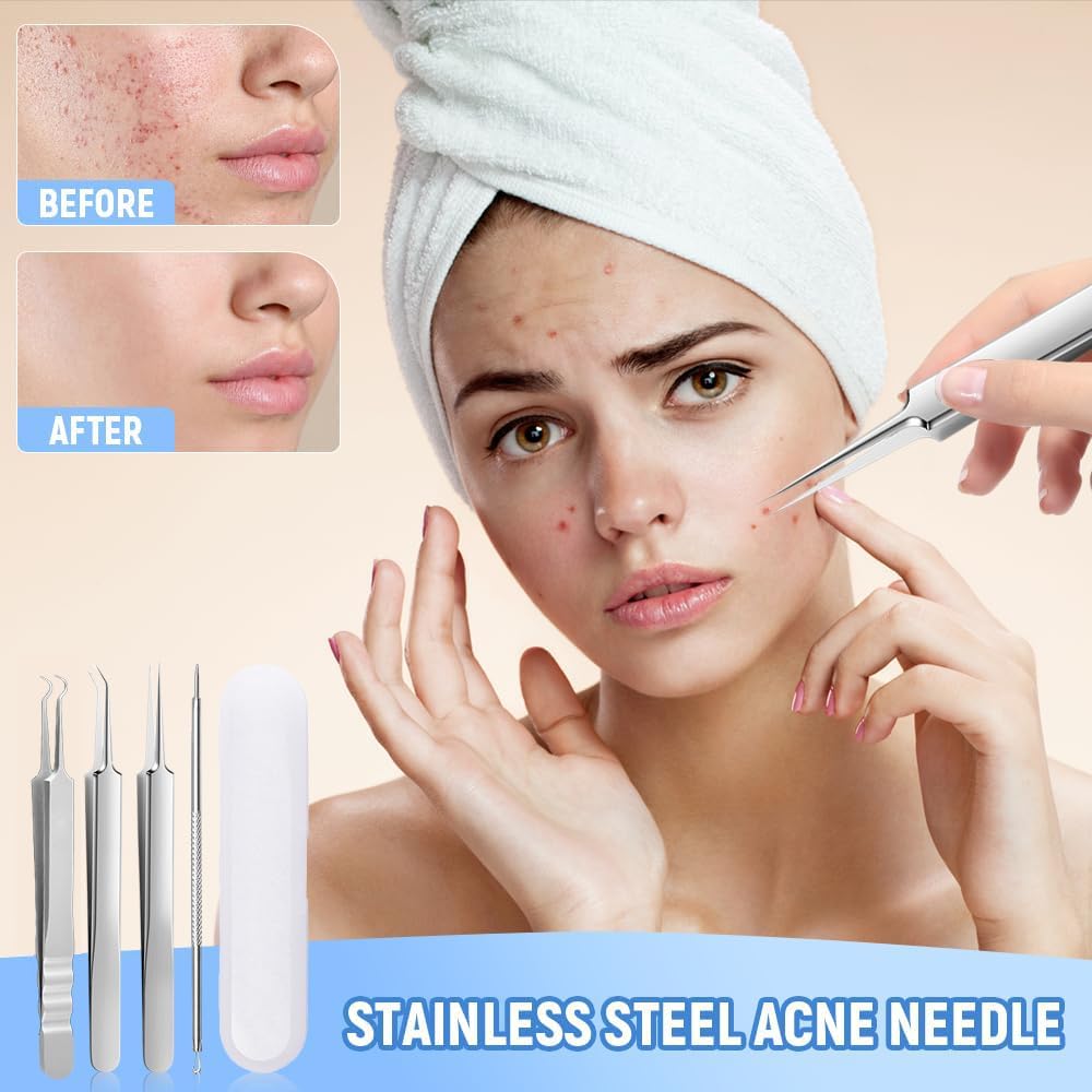 DermaSteel – Precision Stainless Steel Pore Cleaner Kit