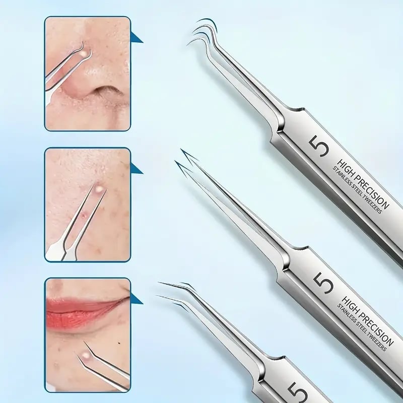 DermaGrip – Professional Blackhead Remover Tweezers