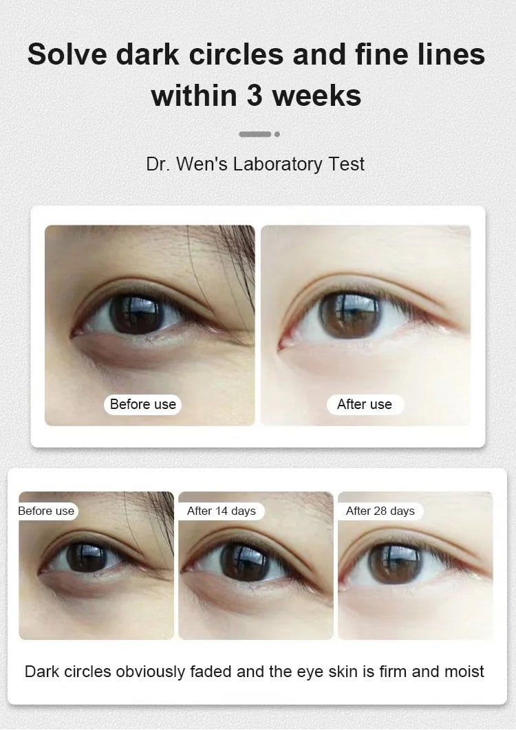 LuteinLift – Nourishing Eye Oil by Dinkiss