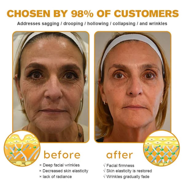 BeeYouth – Botox & Bee Venom Wrinkle Cream