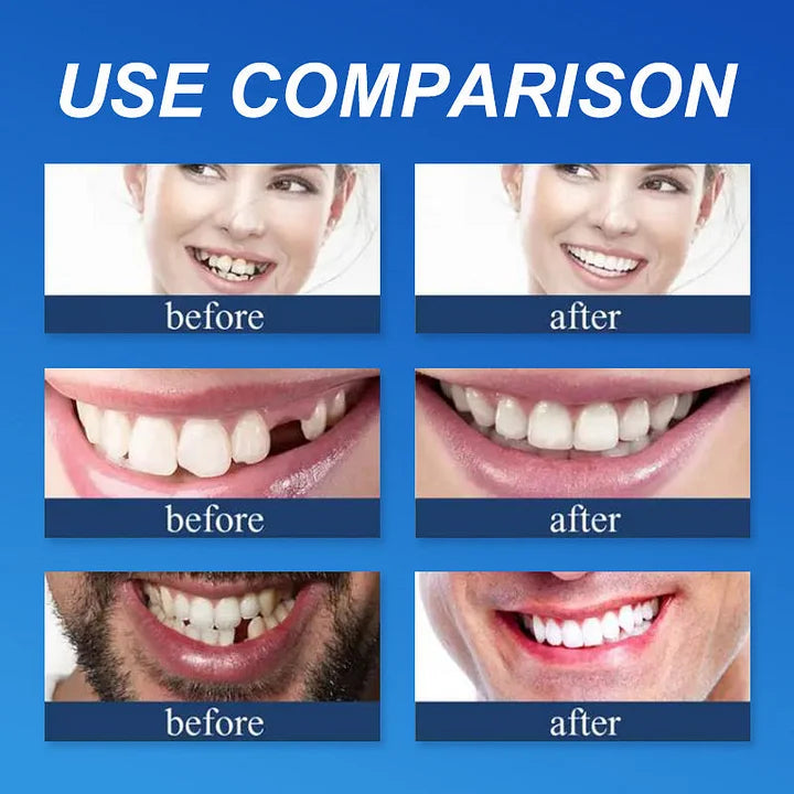 🌎Ends Today: 70% OFF! ⏰Yagoo™ Medical Full Denture with Strong Suctiond🦷Obtain American Dental Association (ADA) Certification