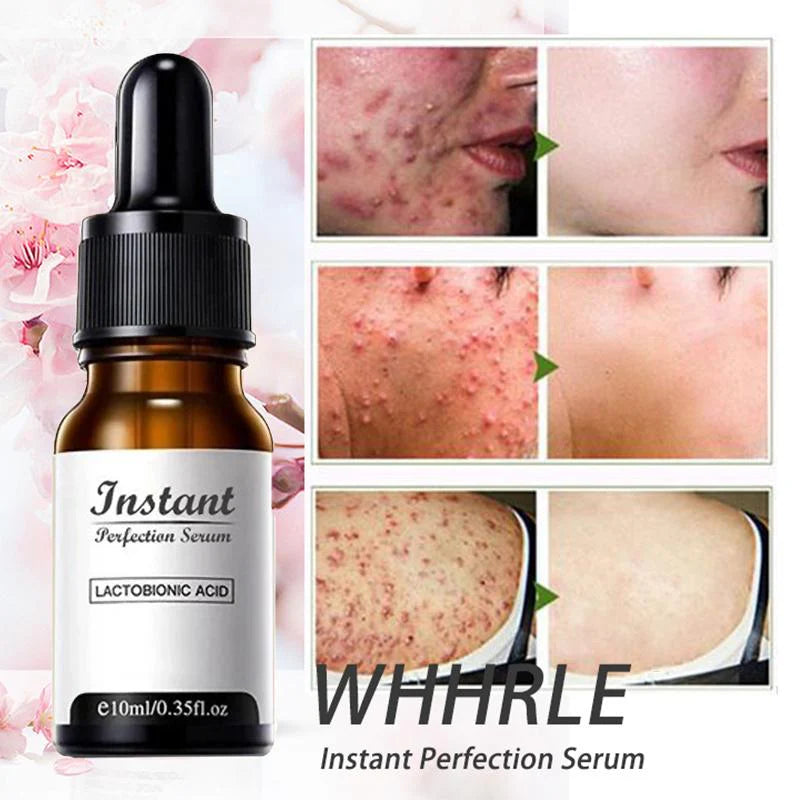 PerfeCure – Instant Wrinkle Essence