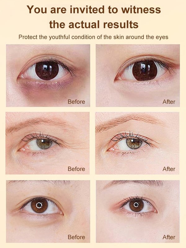 LuteinLift – Nourishing Eye Oil by Dinkiss