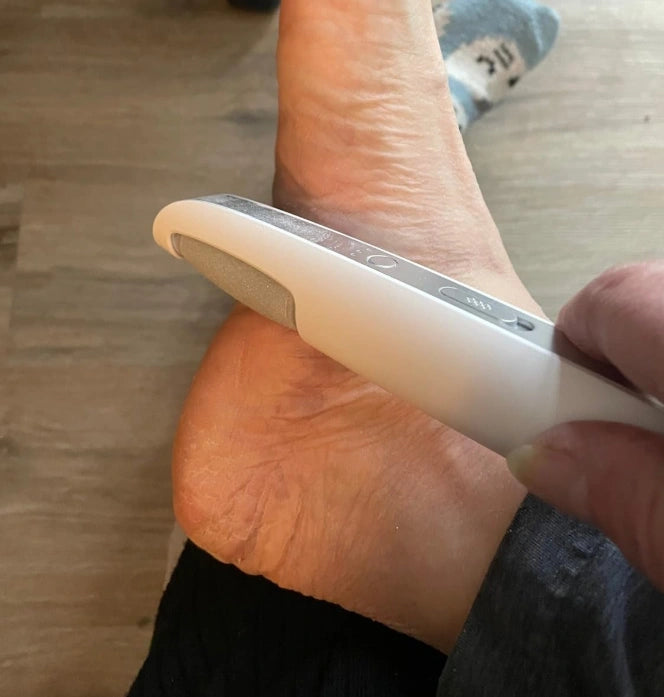 SoleSmooth - Electric Foot Callus Remover