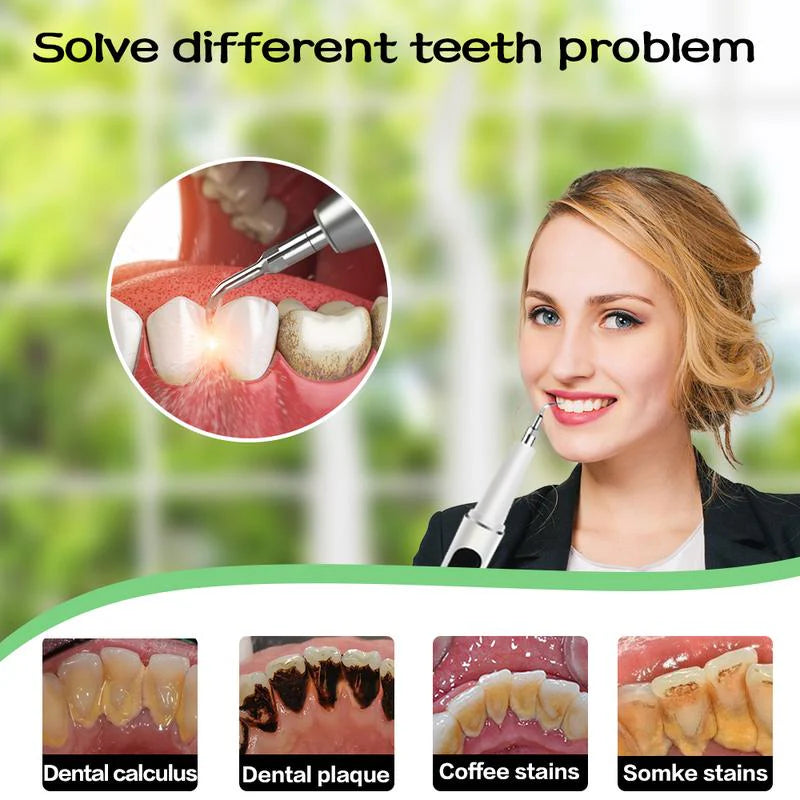 SmileSonic – Ultrasonic Electric Tooth Cleaner