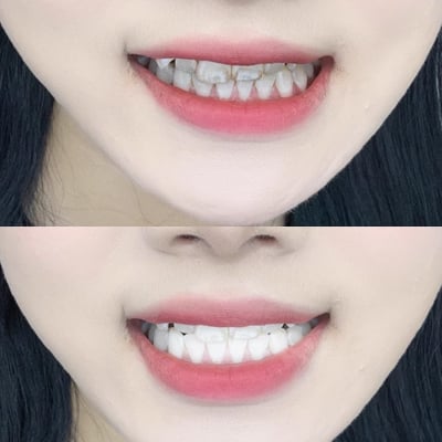 ToothLuxe – Hydroxyapatite Enamel Repair Toothpaste