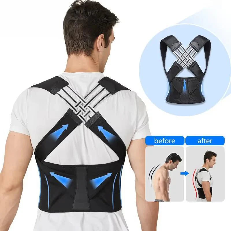 SpineAlign – Adjustable Posture Corrector
