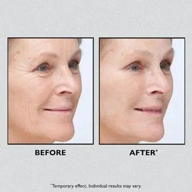 LiftEase – Instant Temporary Face Tightener