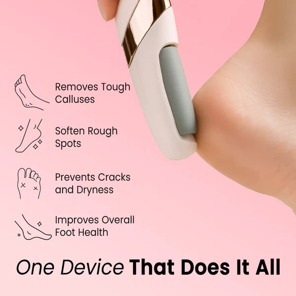 SilkStep – Professional Foot Callus Remover Tool