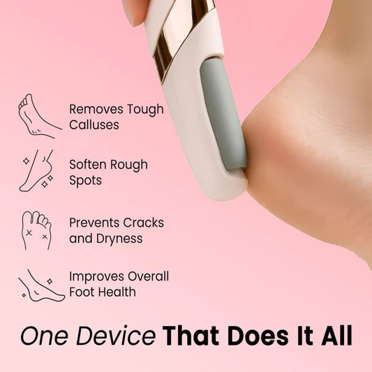 SilkStep – Professional Foot Callus Remover Tool