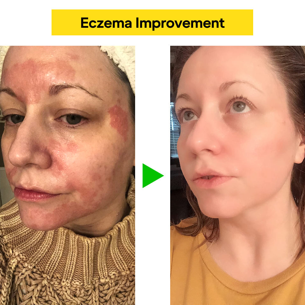 SootheVeda - Skin Recovery Balm