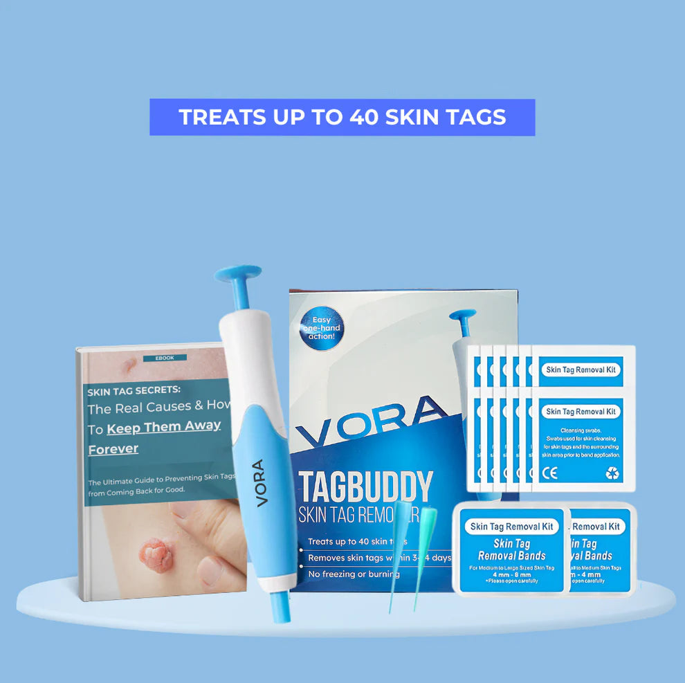 TagBuddyKit – Gentle Skin Tag Remover
