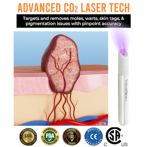 ✨VelvetSkin+™ All-in-One CO₂ Laser Eraser Pen | Removes Moles, Warts, Skin Flaws & Pigmentation