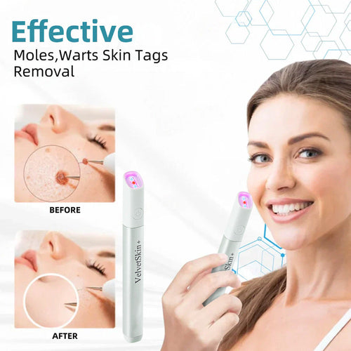 ✨VelvetSkin+™ All-in-One CO₂ Laser Eraser Pen | Removes Moles, Warts, Skin Flaws & Pigmentation