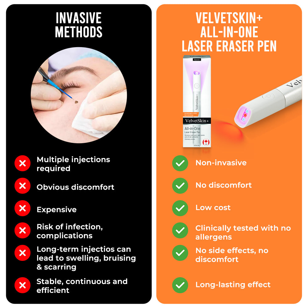 ✨VelvetSkin+™ All-in-One CO₂ Laser Eraser Pen | Removes Moles, Warts, Skin Flaws & Pigmentation