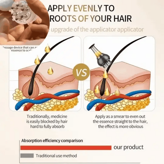 HairZen – Portable Mini Scalp Oil Massager