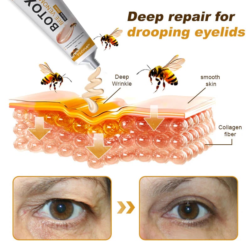 BeeYouth – Botox & Bee Venom Wrinkle Cream
