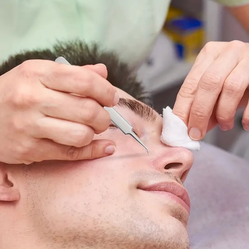 DermaGrip – Professional Blackhead Remover Tweezers