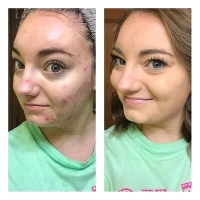 GlowDefine – Multi-Purpose Concealer Palette