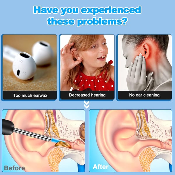 EarGlow – Wireless Ear Cleaning Endoscope