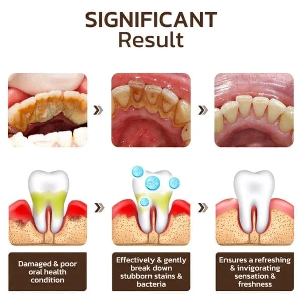 BioSmile| 6-Probiotic Oral Care Toothpaste