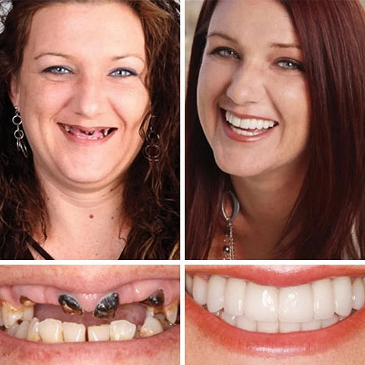 🌎Ends Today: 70% OFF! ⏰Yagoo™ Medical Full Denture with Strong Suctiond🦷Obtain American Dental Association (ADA) Certification
