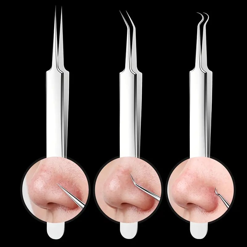 DermaGrip – Professional Blackhead Remover Tweezers
