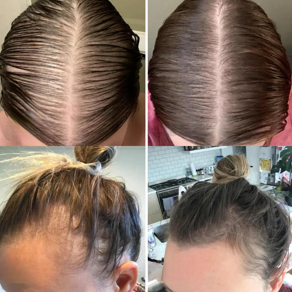 Nature’s Tress – Hair Revitalizing Oil